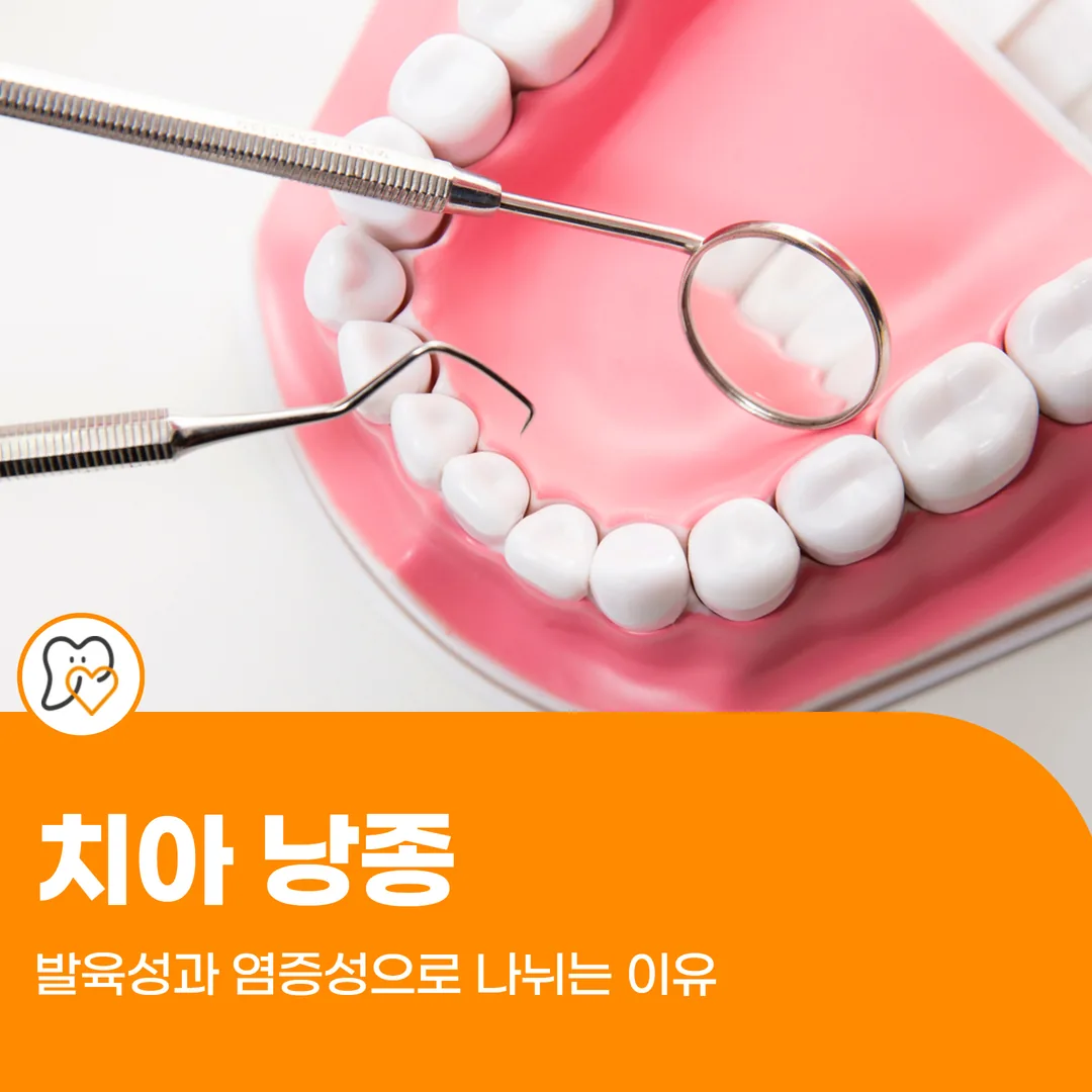 치아 낭종, 발육성과 염증성으로 나뉘는 이유