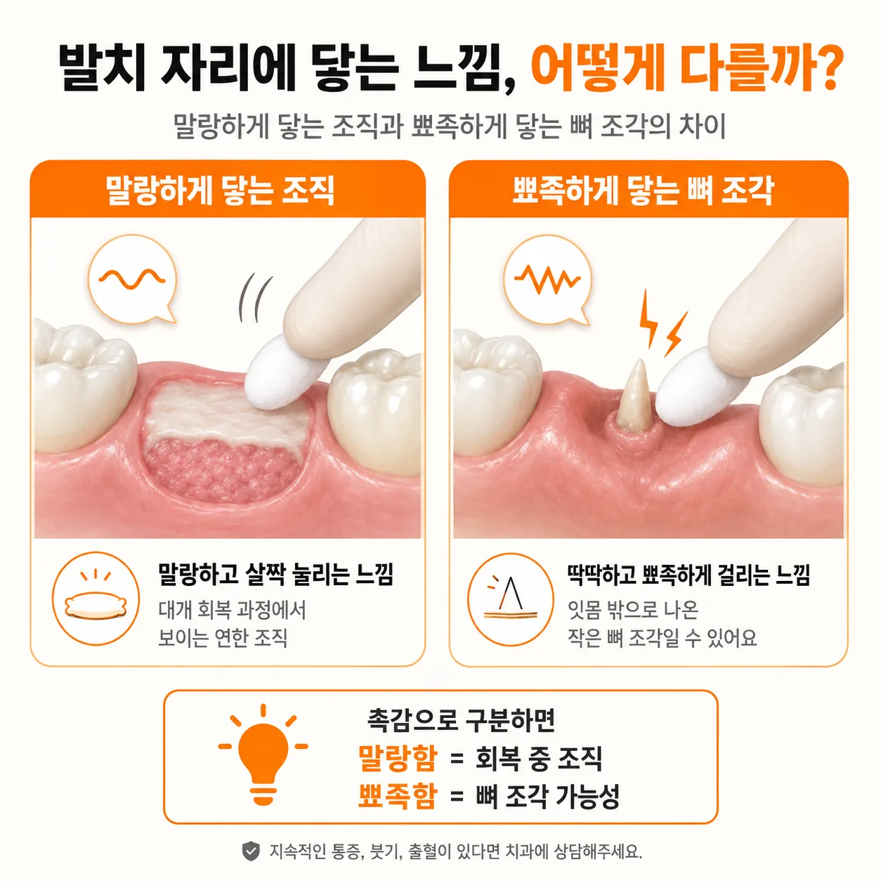 발치 부위에서 조직과 뼈 조각을 촉감으로 구분하는 비교 도해