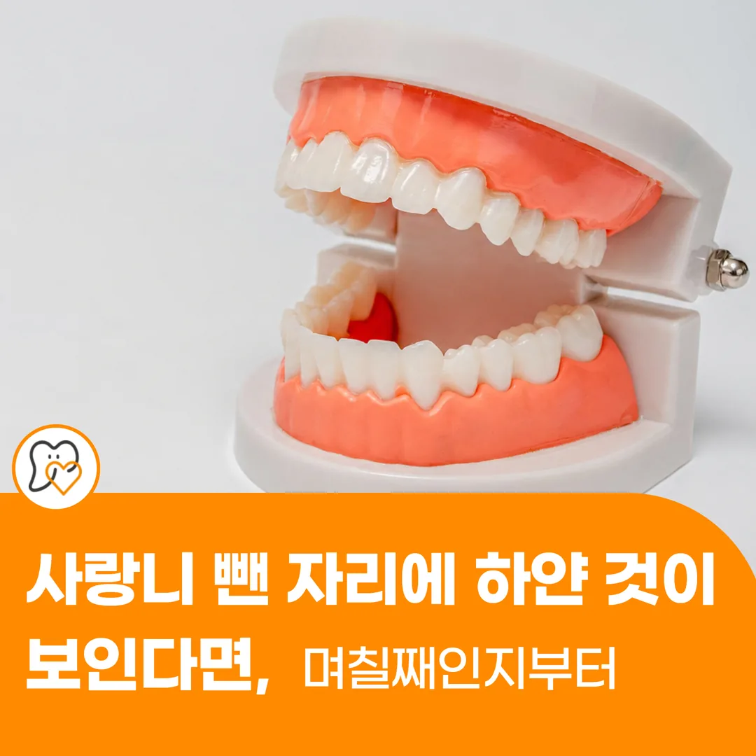 사랑니 뺀 자리에 하얀 것이 보인다면, 며칠째인지부터