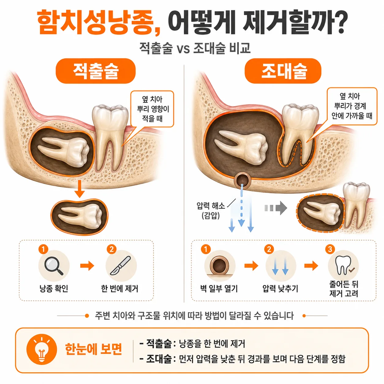 함치성낭종 적출술과 조대술의 차이를 옆 치아 위치 기준으로 비교한 그림