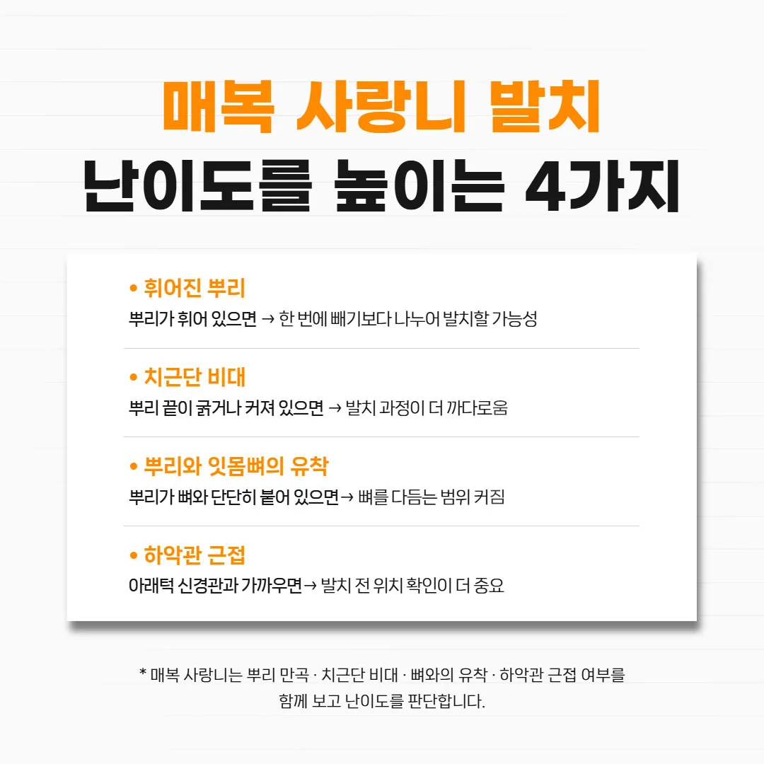 매복 사랑니 발치의 난이도를 높이는 뿌리 만곡·치근단 비대·유착·하악관 근접을 표시한 도해