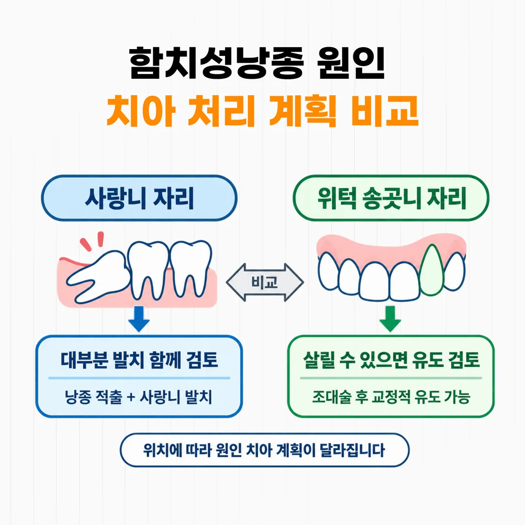 함치성낭종 원인 치아 처리 계획 비교 도식