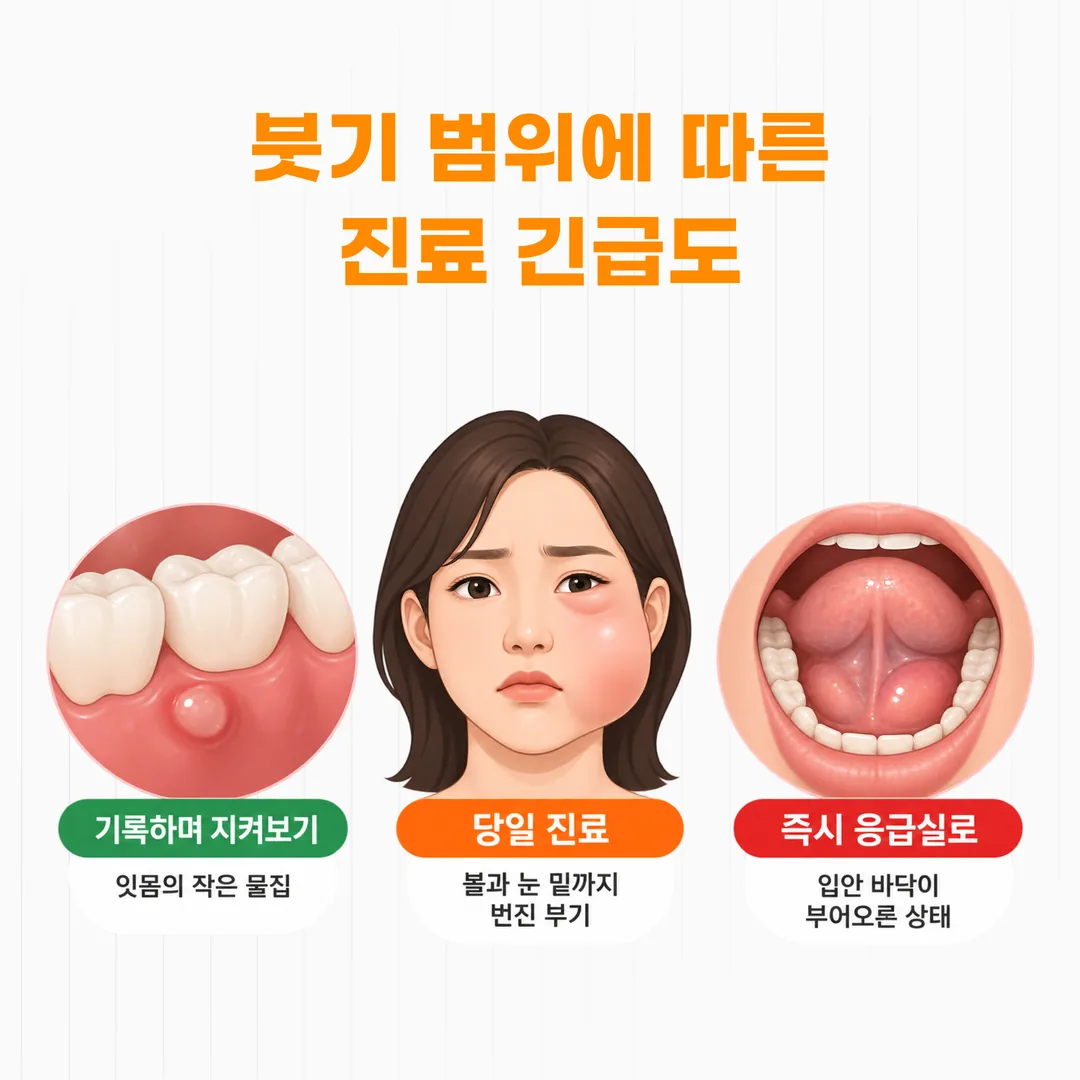 붓기 신호를 긴급도에 따라 세 단계로 나눈 구분도