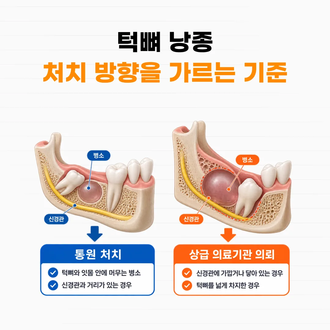 턱뼈 낭종 처치 범위와 상급 의료기관 의뢰 기준을 표시한 아래턱 단면 도식
