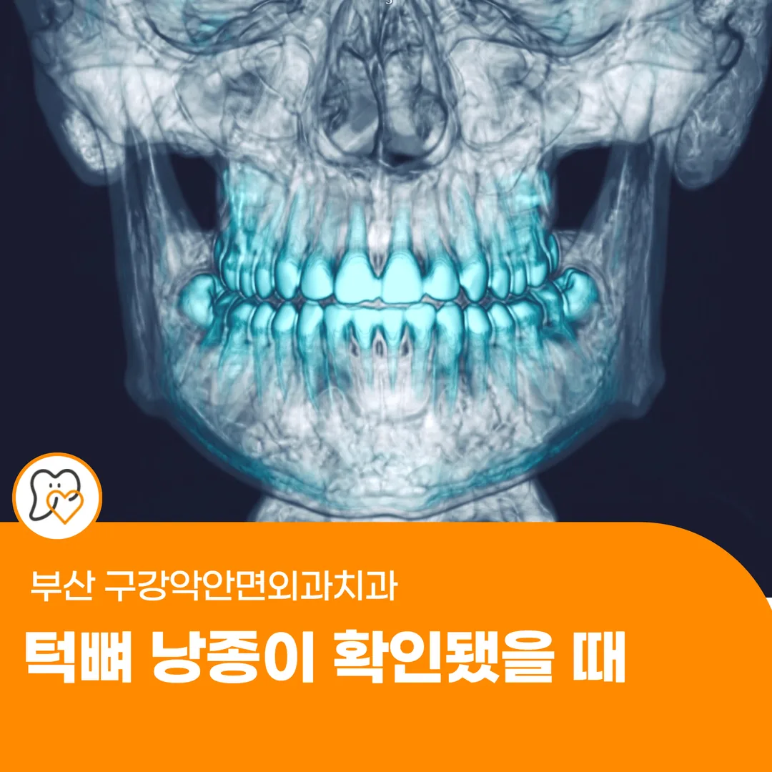 부산 구강악안면외과치과 — 턱뼈 낭종이 확인됐을 때